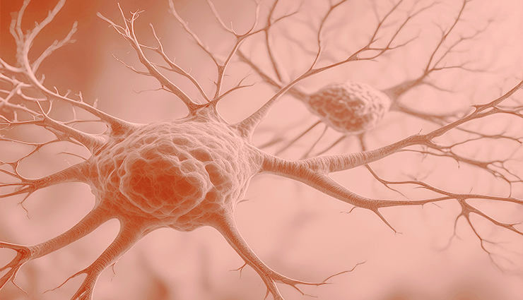 Estudio genético para el diagnóstico de Parkinson Estudio genético para el diagnóstico de Parkinson